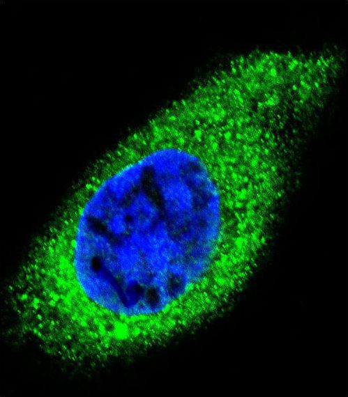 Confocal immunofluorescent of COL21A1 Antibody with HepG2 cell followed by Alexa Fluor 488-conjugated goat anti-rabbit lgG (green). DAPI was used to stain the cell nuclear (blue).