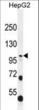 COL21A1 Antibody western blot of HepG2 cell line lysates (35 ug/lane). The COL21A1 antibody detected the COL21A1 protein (arrow).
