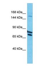 Western blot of COL22A1 Antibody with human HT1080 Whole Cell lysate.