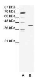 A: Marker, B: HepG2 Cell Lysate