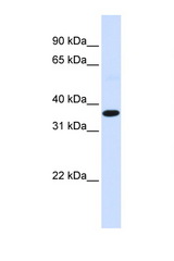 FOS / c-FOS antibody LS-C112301 Western blot of Fetal Muscle lysate. Antibody concentration 1 ug/ml.