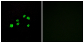 Immunofluorescence of HepG2 cells, using Collagen XXIII alpha1 Antibody. The picture on the right is treated with the synthesized peptide.