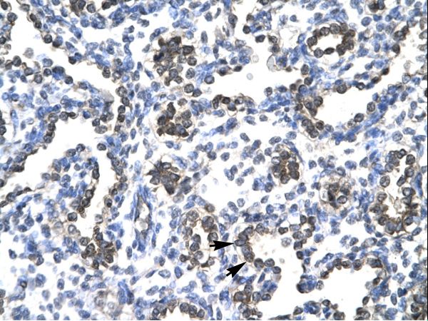 FOSB antibody LS-C30806 was used in IHC to stain formalin-fixed, paraffin-embedded human lung.