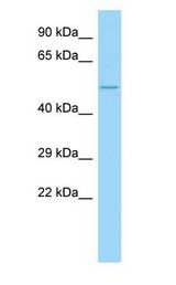 COL23A1 / Collagen XXIII antibody Western Blot of Fetal Liver.