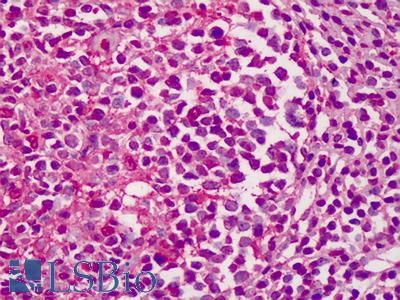 Anti-COL25A1 antibody IHC of human tonsil. Immunohistochemistry of formalin-fixed, paraffin-embedded tissue after heat-induced antigen retrieval. Antibody LS-B664 concentration 5 ug/ml.