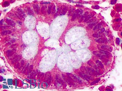 Anti-COL25A1 antibody IHC of human colon. Immunohistochemistry of formalin-fixed, paraffin-embedded tissue after heat-induced antigen retrieval. Antibody LS-B664 concentration 5 ug/ml.