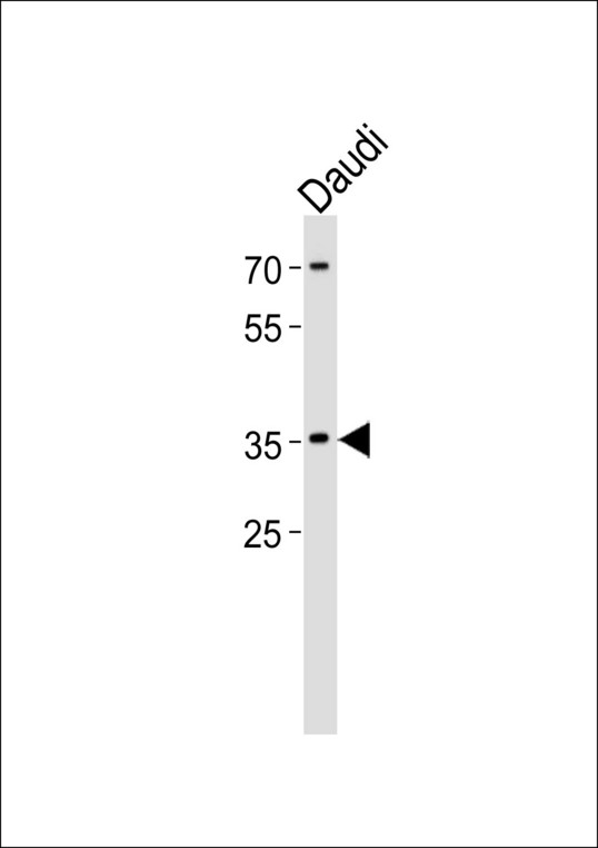 Western blot of lysate from Daudi cell line, using FOSL2 Antibody. Antibody was diluted at 1:1000. A goat anti-rabbit IgG H&L (HRP) at 1:5000 dilution was used as the secondary antibody. Lysate at 35ug.