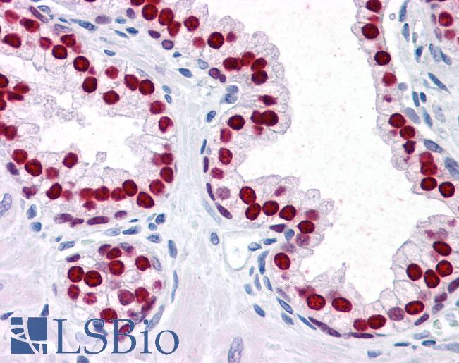 Anti-FOXA1 antibody IHC of human prostate. Immunohistochemistry of formalin-fixed, paraffin-embedded tissue after heat-induced antigen retrieval. Antibody LS-B4356 concentration 5 ug/ml.