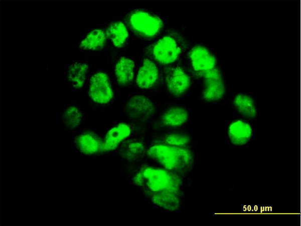 Immunofluorescence of monoclonal antibody to FOXA1 on A-431 cell (antibody concentration 10 ug/ml).