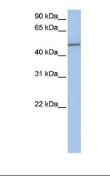 Jurkat cell lysate. Antibody concentration: 1.0 ug/ml. Gel concentration: 12%.