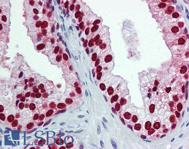 Anti-FOXA1 antibody IHC of human prostate. Immunohistochemistry of formalin-fixed, paraffin-embedded tissue after heat-induced antigen retrieval. Antibody LS-B6101 concentration 5 ug/ml.