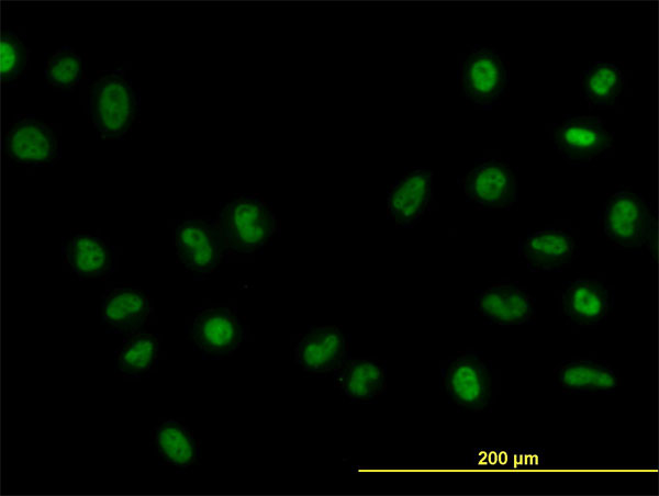 Immunofluorescence of monoclonal antibody to FOXA1 on HeLa cell. [antibody concentration 10 ug/ml]