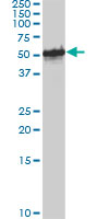 Western blot of FOXA1 expression in HepG2 cell lysate.