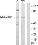 Western blot of extracts from Jurkat/A549 cells, using Collagen XXV alpha1 Antibody. The lane on the right is treated with the synthesized peptide.