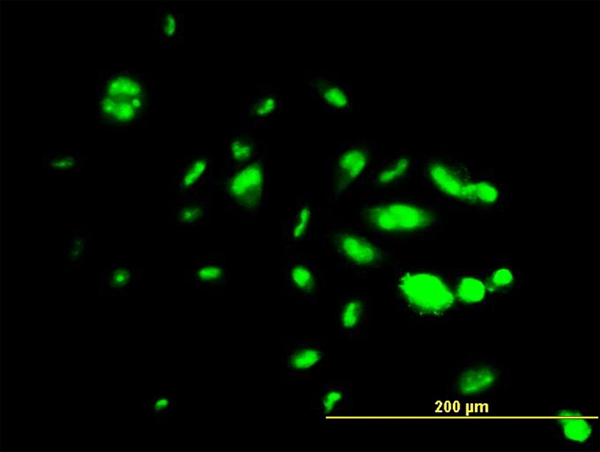 Immunofluorescence of monoclonal antibody to FOXA1 on HepG2 cell. [antibody concentration 10 ug/ml]