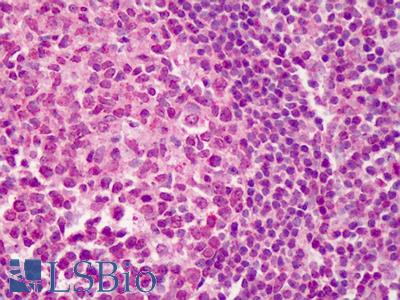 Anti-COL25A1 antibody IHC of human tonsil. Immunohistochemistry of formalin-fixed, paraffin-embedded tissue after heat-induced antigen retrieval. Antibody LS-B663 concentration 5 ug/ml.