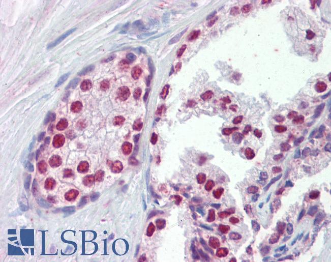 Anti-FOXA1 antibody IHC of human prostate. Immunohistochemistry of formalin-fixed, paraffin-embedded tissue after heat-induced antigen retrieval. Antibody LS-B3596 concentration 5 ug/ml.