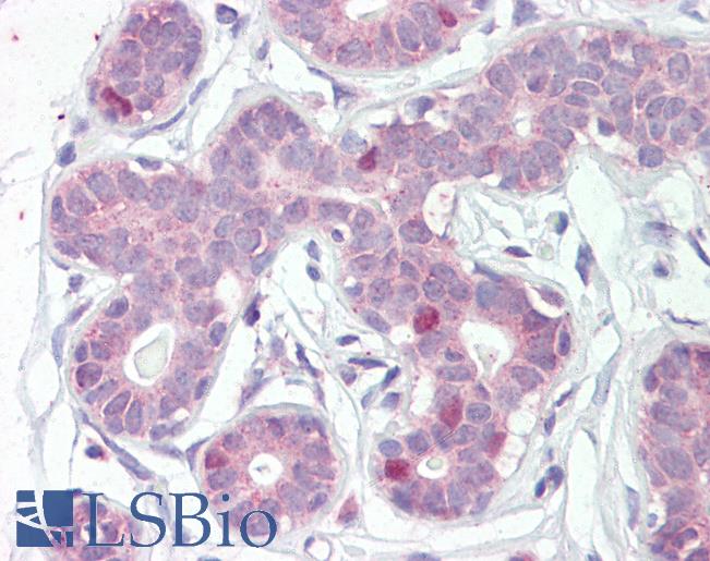 Anti-FOXA1 antibody IHC of human breast. Immunohistochemistry of formalin-fixed, paraffin-embedded tissue after heat-induced antigen retrieval. Antibody LS-B3596 concentration 5 ug/ml.
