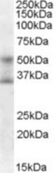 Antibody (0.3 ul/ml) staining of HepG2 cell lysate (35 ug protein in RIPA buffer). Primary incubation was 1 hour. Detected by chemiluminescence.