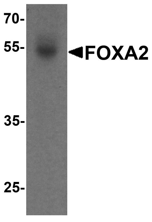 Western blot analysis of FOXA2 in human bladder tissue lysate with FOXA2 antibody at 1 ug/ml.