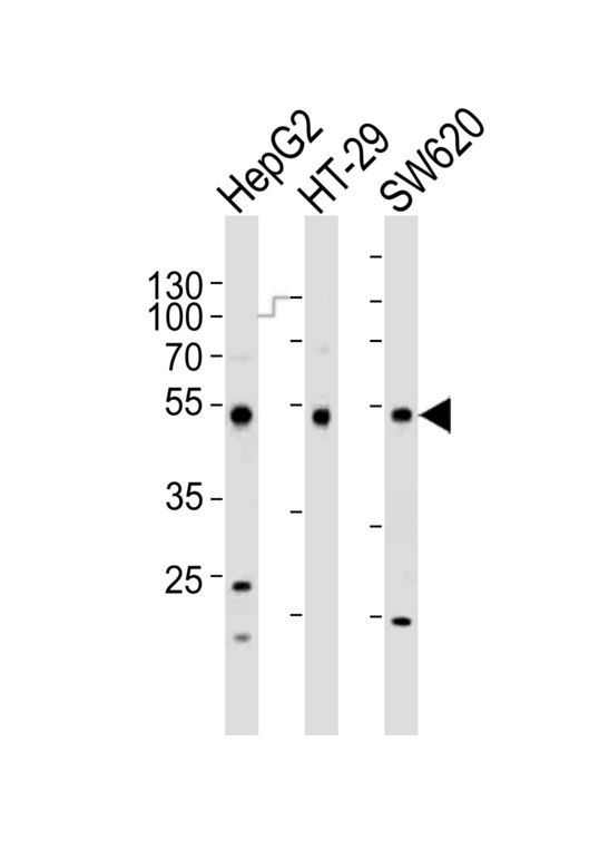 Western blot of lysates from HepG2, HT-29, SW620 cell line (from left to right) with FOXA2 Antibody. Antibody was diluted at 1:1000 at each lane. A goat anti-rabbit IgG H&L (HRP) at 1:10000 dilution was used as the secondary antibody. Lysates at 20 ug per lane.