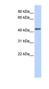 FOXA2 antibody LS-C109625 Western blot of HeLa lysate.