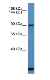 COL27A1 antibody Western Blot of Fetal Lung. Antibody dilution: 1 ug/ml.