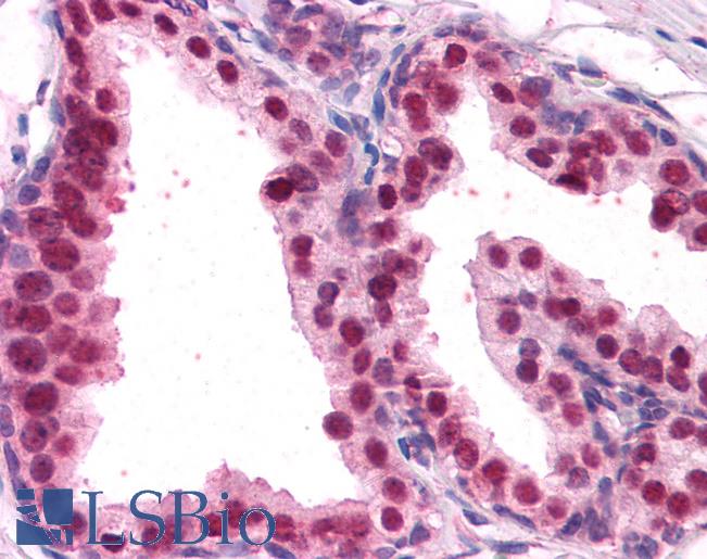 Anti-FOXA2 antibody IHC of human prostate. Immunohistochemistry of formalin-fixed, paraffin-embedded tissue after heat-induced antigen retrieval. Antibody LS-B3929 concentration 3.75 ug/ml.