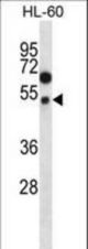 FOXA2 Antibody (pT156) western blot of HL-60 cell line lysates (35 ug/lane). The FOXA2 antibody detected the FOXA2 protein (arrow).