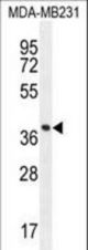 FOXA2 Antibody western blot of MDA-MB231 cell line lysates (35 ug/lane). The FOXA2 antibody detected the FOXA2 protein (arrow).