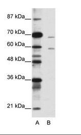 A: Marker, B: Jurkat Cell Lysate