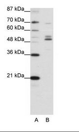 A: Marker, B: HepG2 Cell Lysate