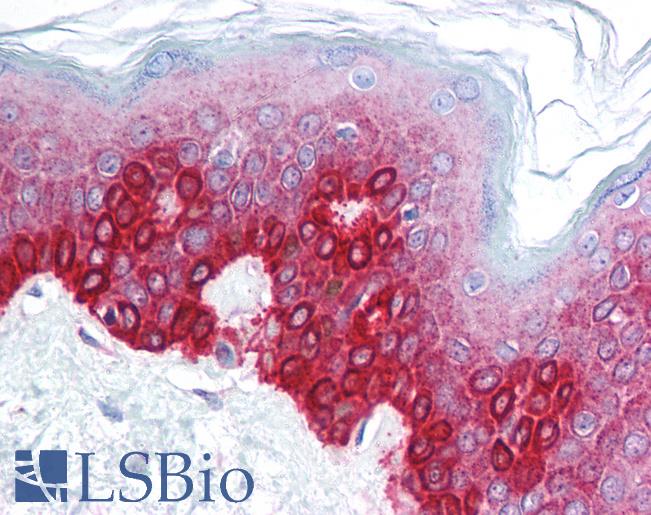 Anti-FOXA3 antibody IHC of human skin. Immunohistochemistry of formalin-fixed, paraffin-embedded tissue after heat-induced antigen retrieval. Antibody LS-B947 concentration 5 ug/ml.