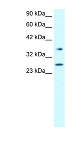 FOXA3 antibody LS-B947 Western blot of Jurkat lysate.
