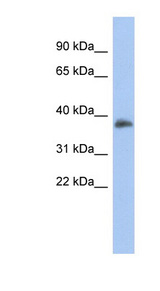 FOXB1 antibody LS-C110079 Western blot of Fetal Spleen lysate.