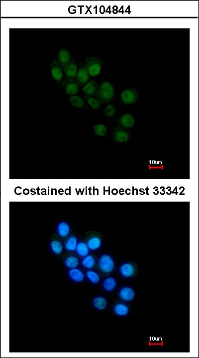 Immunofluorescence of paraformaldehyde-fixed HepG2, using FOXB1 antibody at 1:200 dilution.