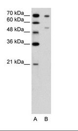 A: Marker, B: Jurkat Cell Lysate