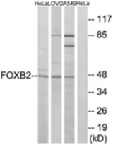 Western blot of extracts from HeLa/LOVO/A549 cells, using FOXB2 Antibody. The lane on the right is treated with the synthesized peptide.