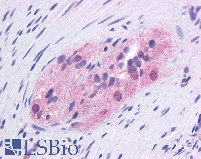 Anti-FOXC1 antibody IHC of human colon, myenteric plexus. Immunohistochemistry of formalin-fixed, paraffin-embedded tissue after heat-induced antigen retrieval. Antibody LS-B4579 concentration 5 ug/ml.
