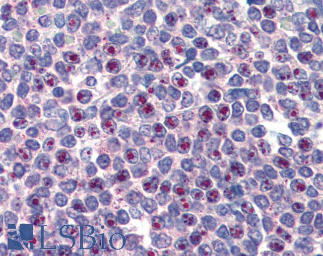 Anti-FOXC1 antibody IHC of human spleen. Immunohistochemistry of formalin-fixed, paraffin-embedded tissue after heat-induced antigen retrieval. Antibody LS-B2996 concentration 75 ug/ml.