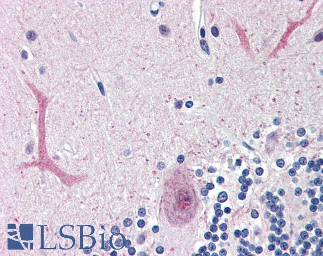 Anti-FOXC1 antibody IHC of human brain, cerebellum. Immunohistochemistry of formalin-fixed, paraffin-embedded tissue after heat-induced antigen retrieval. Antibody LS-B2996 concentration 75 ug/ml.
