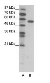 A: Marker, B: Jurkat Cell Lysate