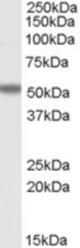 Antibody staining (1 ug/ml) of Human Breast Cancer lysate (RIPA buffer, 30 ug total protein per lane). Primary incubated for 1 hour. Detected by Western blot of chemiluminescence.