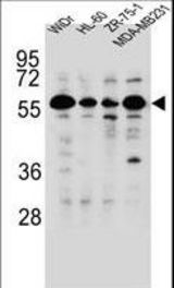 FOXC2 Antibody (Center P198) western blot of WiDr,HL-60,ZR-75-1,MDA-MB231 cell line lysates (35 ug/lane). The FOXC2 antibody detected the FOXC2 protein (arrow).