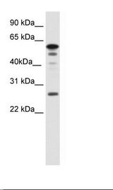 SP2/0 Cell Lysate