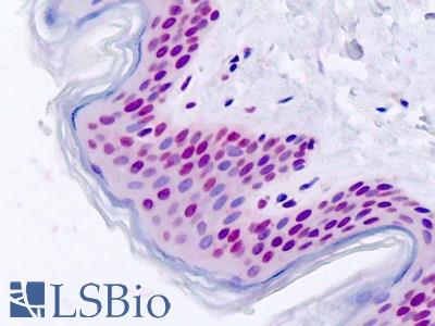 Human, Skin: Formalin-Fixed Paraffin-Embedded (FFPE)