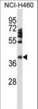 FOXD1 Antibody western blot of HepG2 cell line lysates (35 ug/lane). The FOXD1 antibody detected the FOXD1 protein (arrow).
