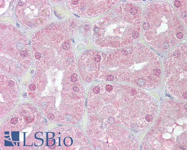 Anti-FOXD1 antibody IHC of human kidney. Immunohistochemistry of formalin-fixed, paraffin-embedded tissue after heat-induced antigen retrieval. Antibody LS-B6453 concentration 2.5 ug/ml.