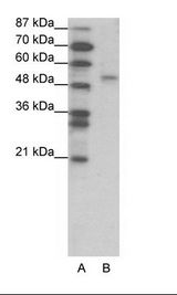 A: Marker, B: Jurkat Cell Lysate