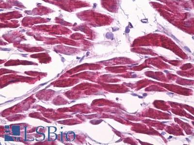 Anti-FOXD3 antibody IHC of human heart. Immunohistochemistry of formalin-fixed, paraffin-embedded tissue after heat-induced antigen retrieval. Antibody LS-B7060 concentration 10 ug/ml.